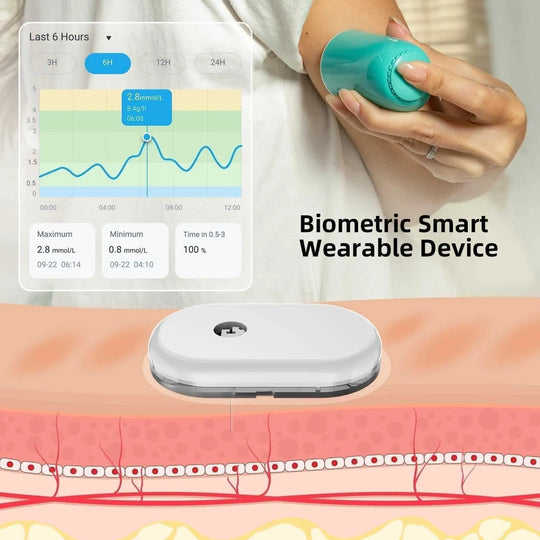 SiBio KS1 Continuous Ketone Monitoring System (CKM) - SIBIONICS